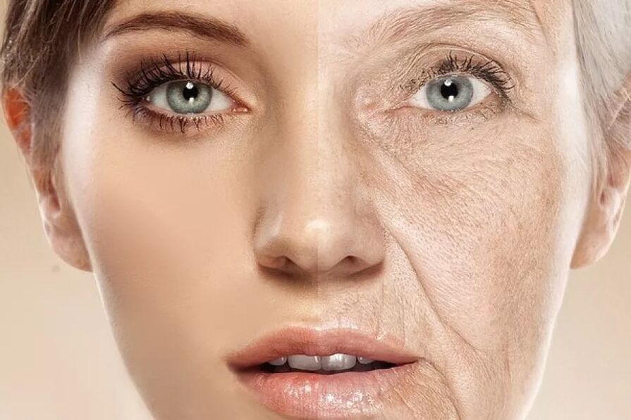 Kůže obličeje po a před vystavením frakčnímu ablativnímu laseru