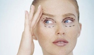 typy blefaroplastiky pro omlazení pokožky kolem očí